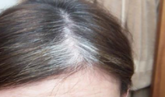 no-dermatologist-will-ever-tell-you-about-this-gray-hair-problem-and-how-to-solve-it-8754495