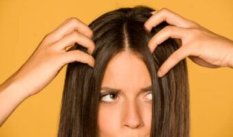 9-natural-ways-to-get-rid-of-dandruff-forever-2